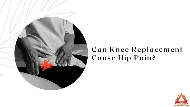 Can Knee Replacement Cause Hip Pain