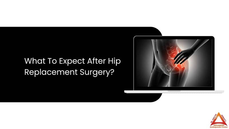 What To Expect After Hip Replacement Surgery