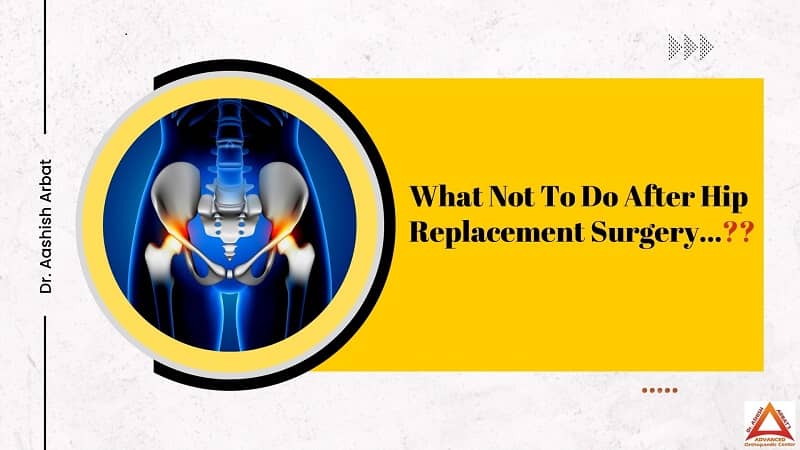 What Not To Do After Hip Replacement Surgery