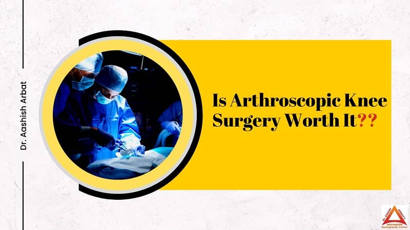 Is Arthroscopic Knee Surgery Worth It