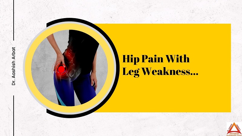 Hip Pain with Leg Weakness