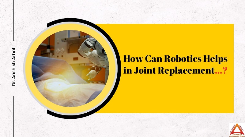 How Can Robotics Helps in Joint Replacement