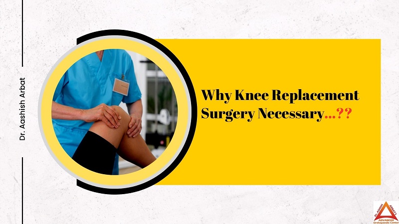 Why Knee Replacement Surgery Necessary