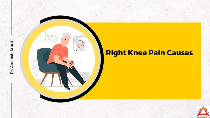 Right Knee Pain Causes