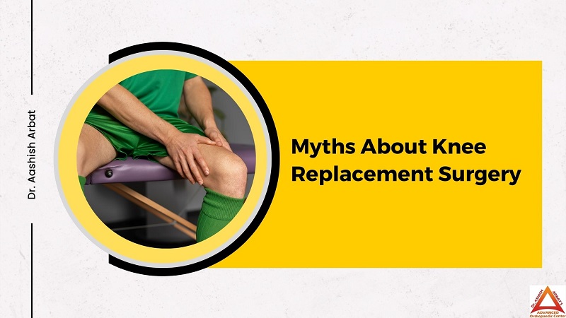 Myths About Knee Replacement Surgery