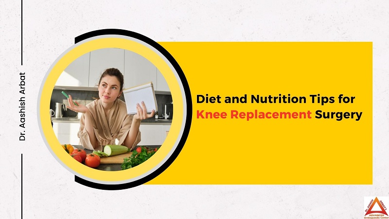 Diet and Nutrition Tips for Knee Replacement Surgery