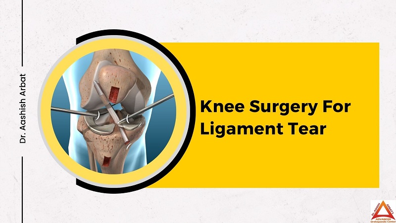 Knee Surgery For Ligament Tear