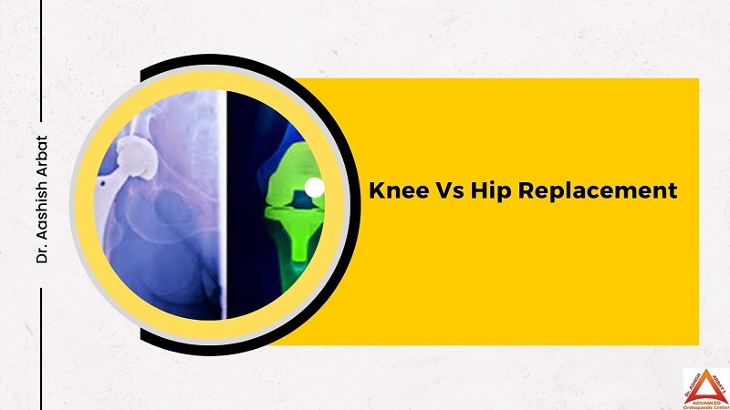 Knee Vs Hip Replacement