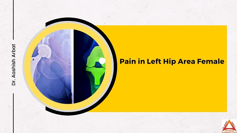 Pain in Left Hip Area Female